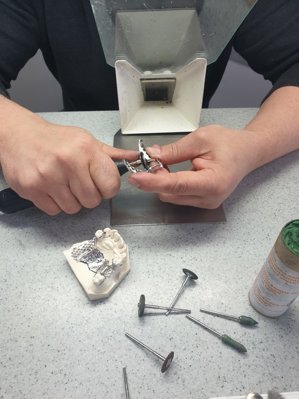 Partial dentures - complete prosthetic replacement for partly or completely toothless jaw – advanced