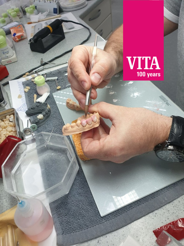 Cirkonske konstrukcije: od pripreme do individualizacije keramike