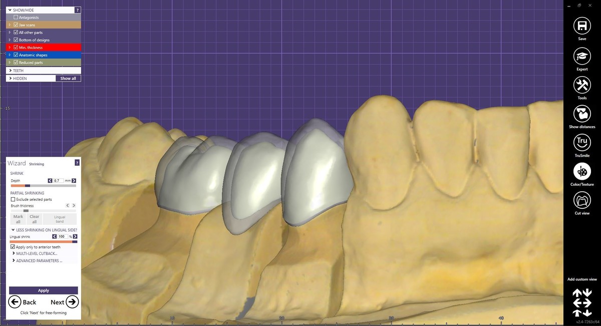 BEOGRAD - EXOCAD – DentalCAD