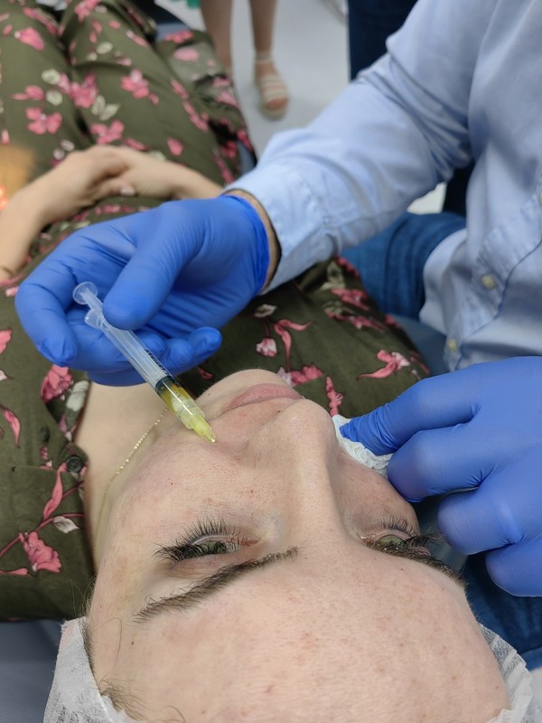 Pomlađivanje lica - Primjena plazme bogate faktorima rasta u estetskoj medicini