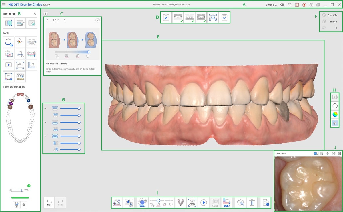 MEDIT intraoralni skener u svakodnevnoj praksi – skeniraj, modeliraj, isprintaj!