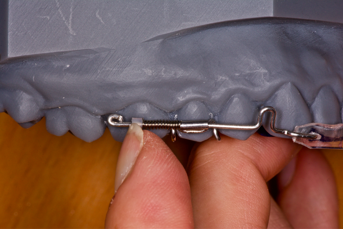IAS Academy – ClearSmile Aligner Light i Inman Aligner Light