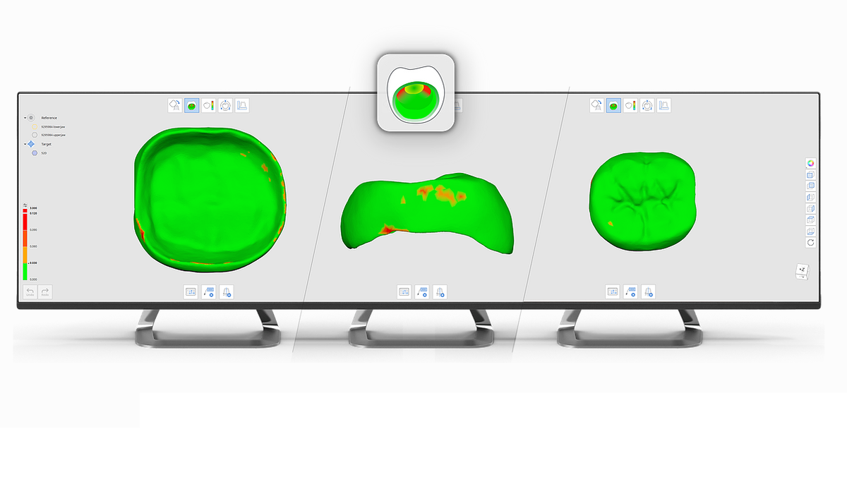 MEDIT intraoralni skener u svakodnevnoj praksi – skeniraj, modeliraj, isprintaj!