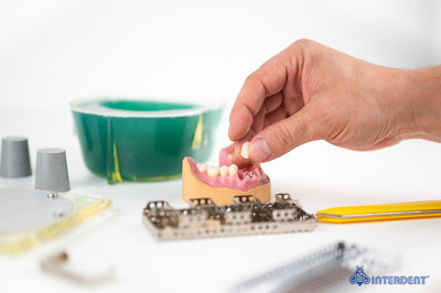 GELCAST СИСТЕМА