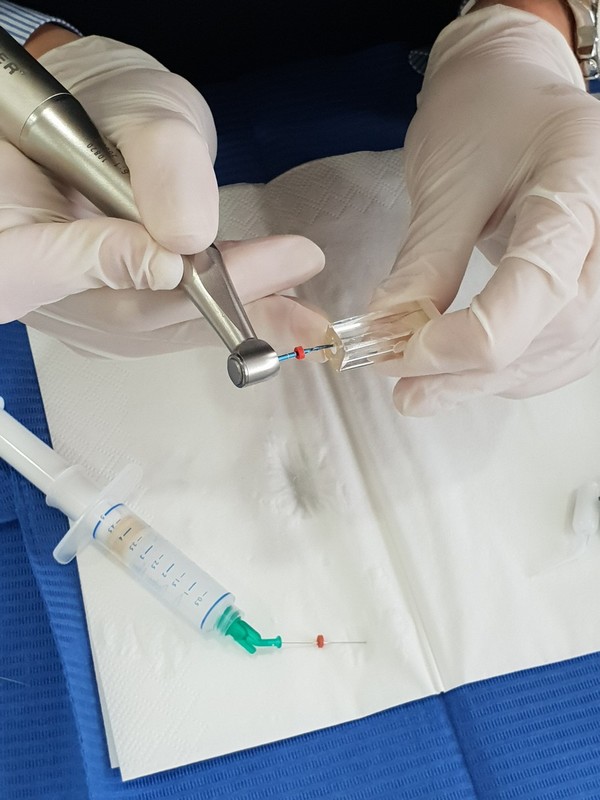 Endodoncija s sistemom Reciproc: put do apeksa
