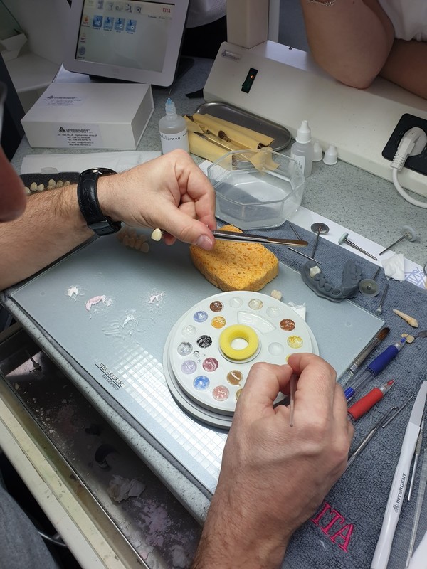 Cirkonske konstrukcije: od pripreme do individualizacije keramike