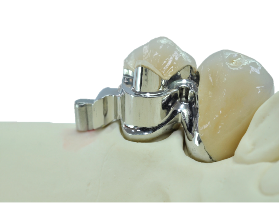 Etečmeni kao estetsko-funkcionalno rješenje u svakodnevnoj praksi - Kombinirani radovi osnovni tečaj