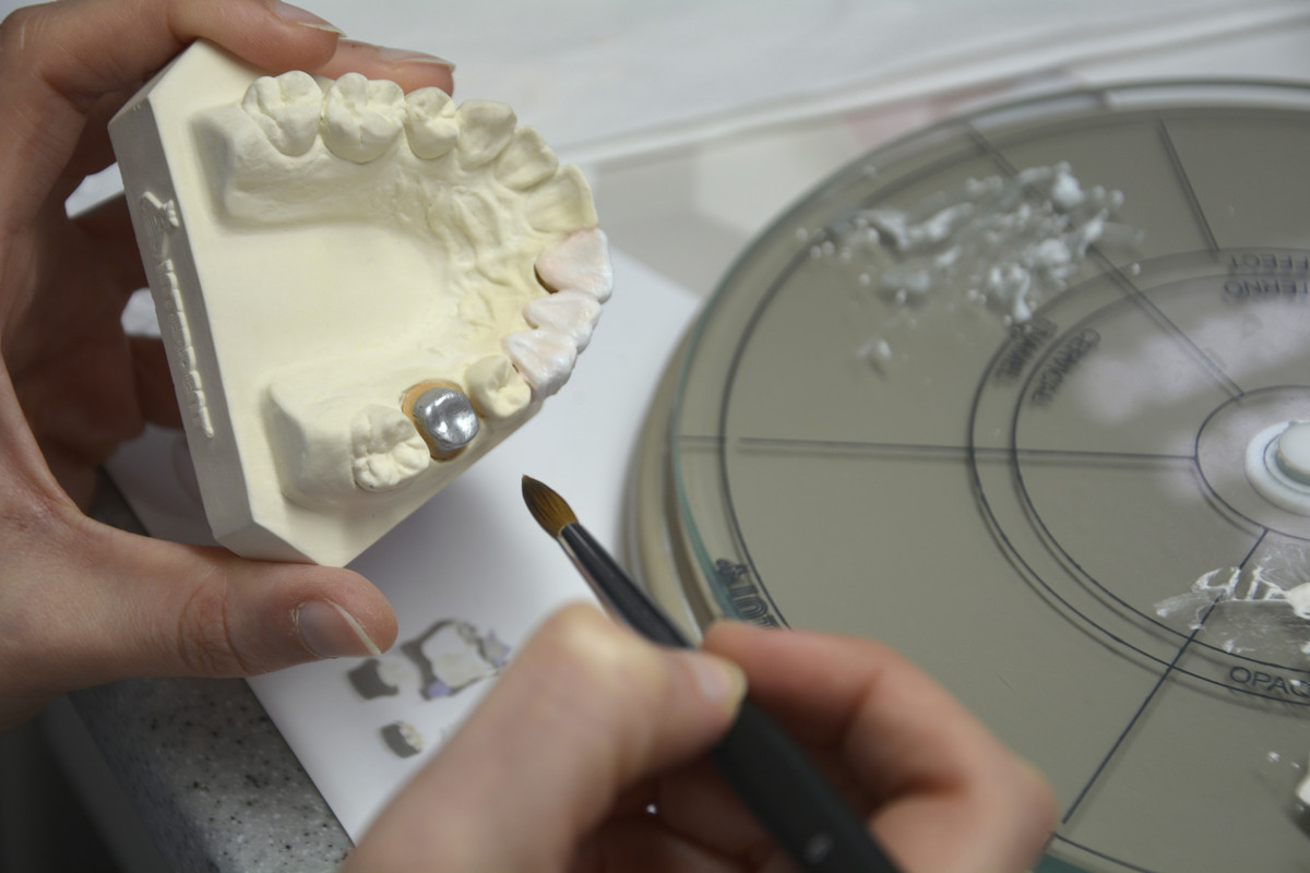 Metalna keramika - napredni tečaj