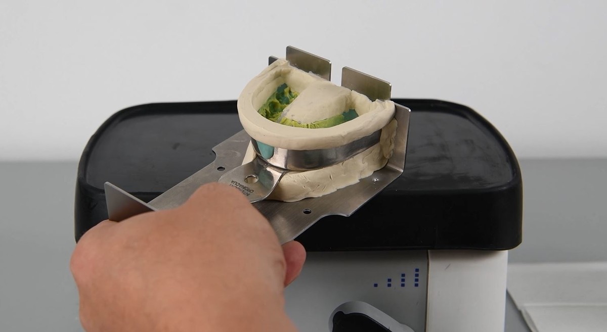 POPUNJENO - SUMMER DENTAL SCHOOL - Za mlade tehničare i učenike završne godine.