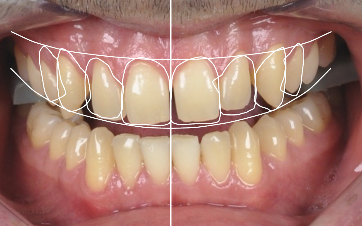 Digital Smile Design Excellence - Masterclass