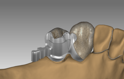 ЦИФРОВАЯ БИБЛИОТЕКА ACRYLOCK